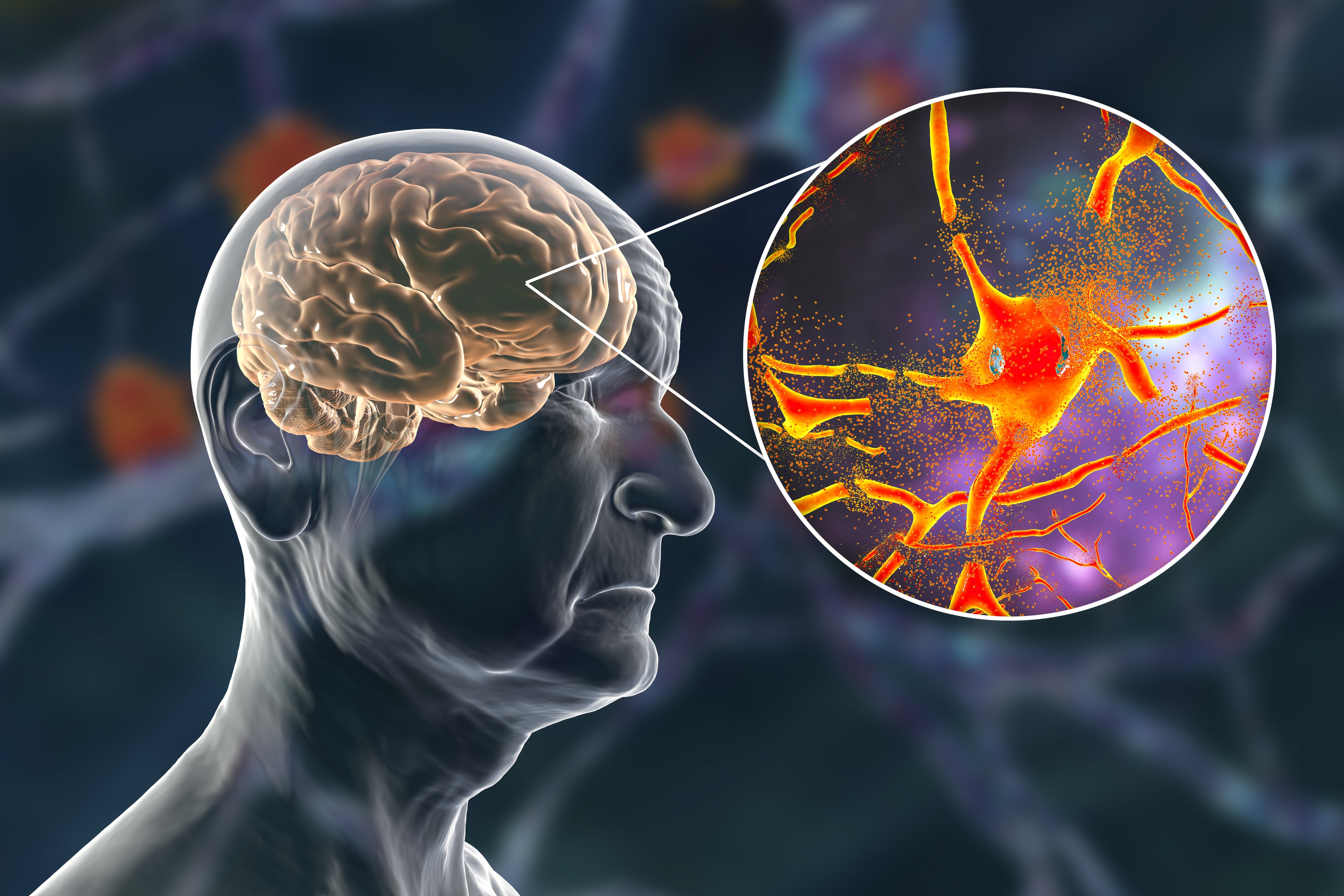 Combat Memory Loss with These Brain-Boosting Foods
